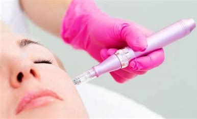 Microagulhamento Facial